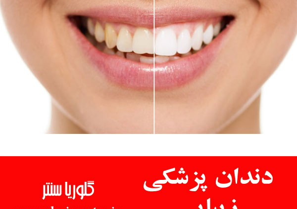 5 درمان مفید دندانپزشکی زیبایی که باید درباره آنها بدانید!