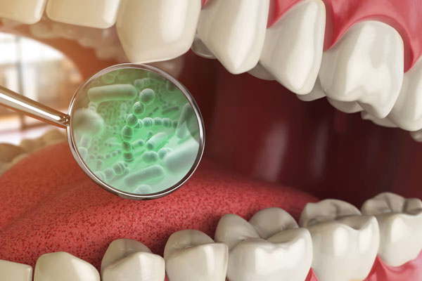 عفونت ایمپلنت دندان؛ راه های پیشگیری و درمان آن