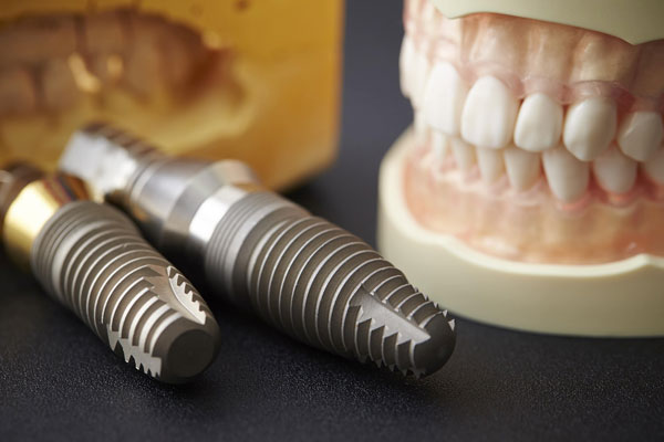 انواع برند ایمپلنت دندان