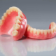 تفاوت ایمپلنت دندان و دندان مصنوعی