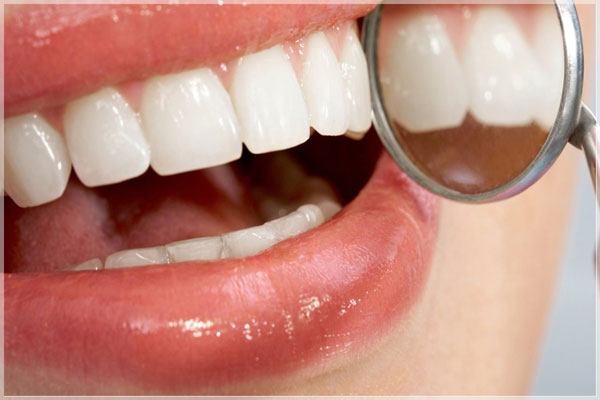 کامپوزیت دندان چیست