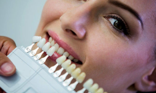 کامپوزیت دندان چگونه نصب می شود؟