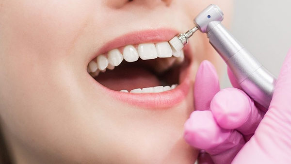 کامپوزیت دندان از چه ماده ای ساخته شده است؟